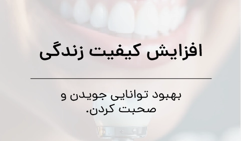 عرفان صفری ایمپلنت