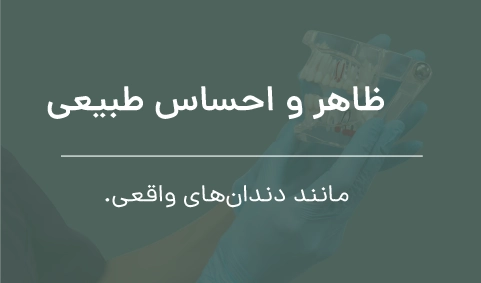 عرفان صفری ایمپلنت