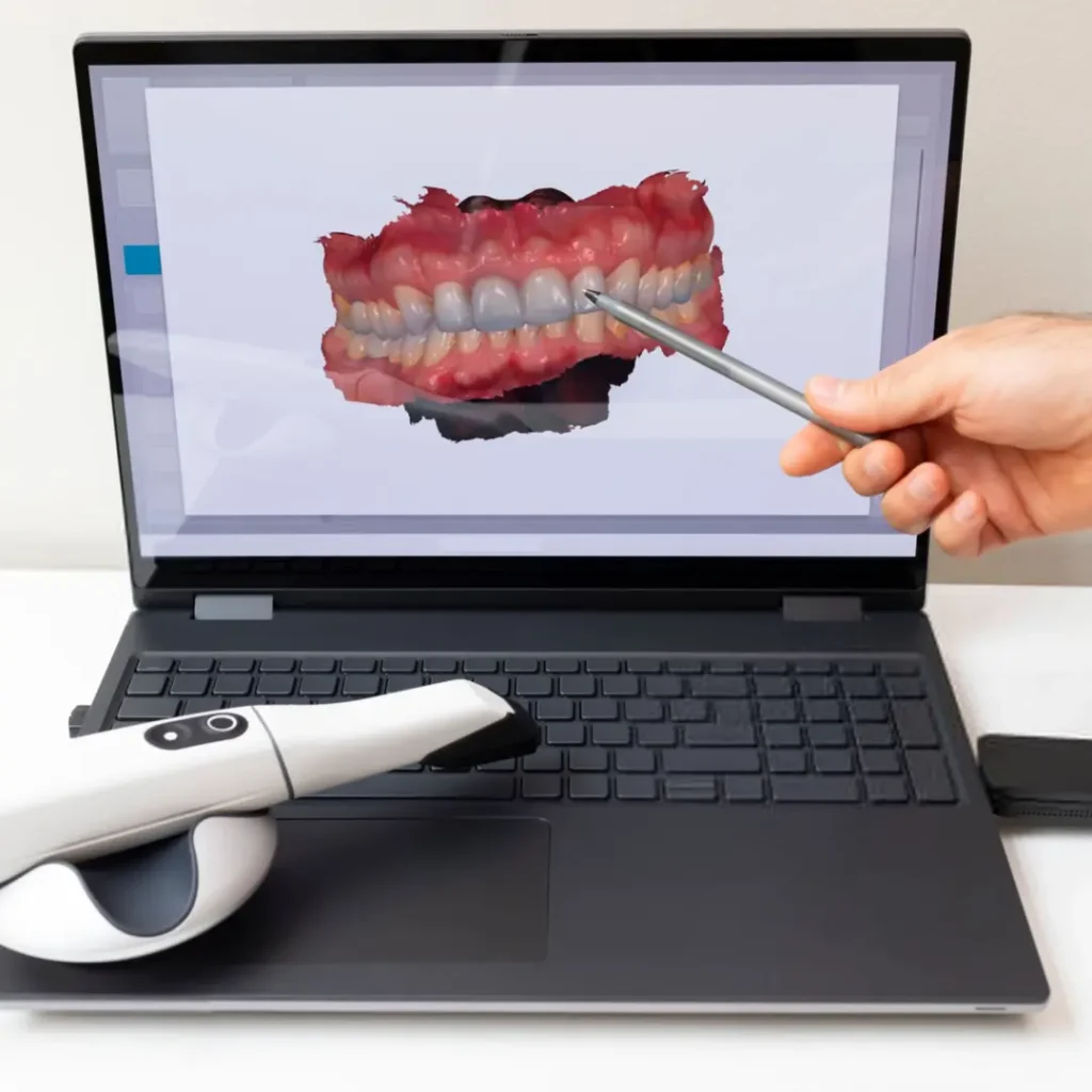 چگونه طراحی لبخند دیجیتال نتایج درمانی را بهبود می ‌بخشد؟